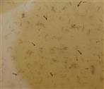 Mückenlarven(Culex vermutlich pipiens)