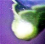 Pflanzengalle(Beutelgalle) an der Spitze eines Blattes einer Pflaume(Prunus domestica(L.))