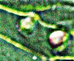 Pflanzengallen auf der Unterseite eines Blattes einer Großen Brennnessel(Urtica dioica(L.))