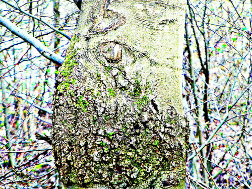 Die Rotbuche(Fagus sylvatica(L.)) kann durch den Pilz Nectia ditissima
befallen werden und es bildet sich "Buchenkrebs."
https://www.waldwissen.net/de/waldwirtschaft/waldbau/bestandespflege/buchenkrebs

Aufnameort: Eiershausen  1. Hirschbergweg
Kamera: Medion Camcorder