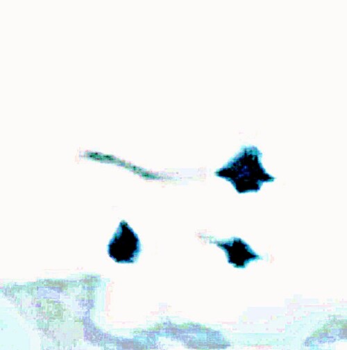 Drei-Hagebutten-mit-Schneehaube-3.jpeg